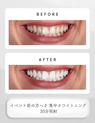 メンズ セルフホワイトニング　アデル所属・戸嶋 菫のエステ・リラクイメージ