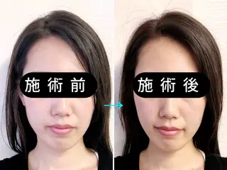 小顔美容鍼専門サロン 渋谷YZのエステ・リラクイメージ