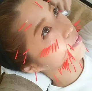 さや 鍼灸院のその他イメージ