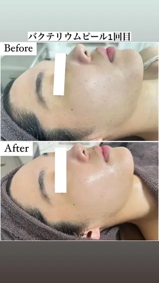 都度払い制脱毛サロンBe Charm所属・Be Charm 山﨑のエステ・リラクイメージ