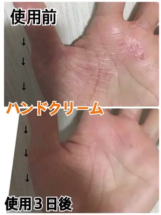 HISUI所属・IVY化粧品・ 勝山亜優奈のエステ・リラクイメージ