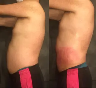 小顔やたるみに特化 💚野瀬可蓮のその他イメージ