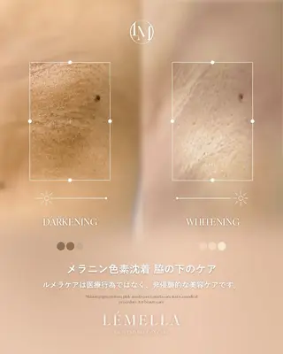 メラニンケアサロンM/é（エムエ）所属・メラニンケア M/é柴田のその他イメージ