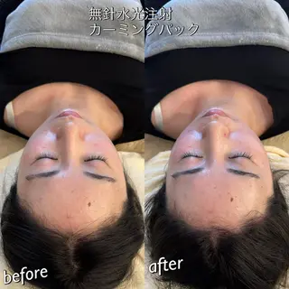 うなじ脱毛/美肌脱毛 LABELのエステ・リラクイメージ