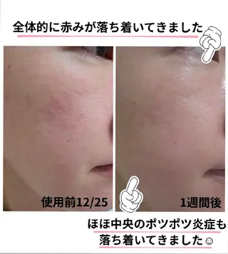 上尾Luce. あきやまのエステ・リラクイメージ