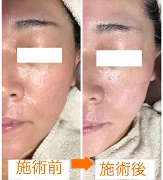 小顔・毛穴・たるみ ネイル　似内真樹のエステ・リラクイメージ