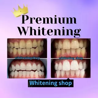 ホワイトニングショップ静岡葵区店所属・ホワイトニング ショップ葵区静岡駅店のその他イメージ