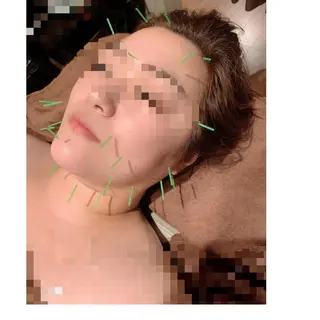 美容鍼灸イロドリ  のエステ・リラクイメージ