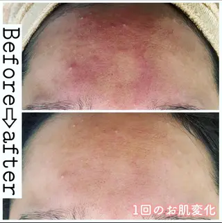 ロング カラー パーマ ヘアアレンジ メンズ キッズ ネイル マツエク・マツパ ニキビ&跡改善サロン オーナー光木のエステ・リラクイメージ