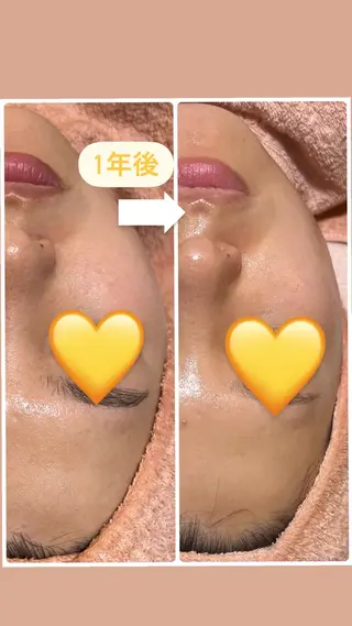 W MISATOのエステ・リラクイメージ