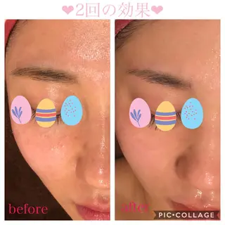 ロング カラー パーマ ヘアアレンジ キッズ ネイル マツエク・マツパ Ensor Clair所属・EnsorClair 代表　野口真央のエステ・リラクイメージ