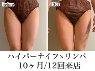 REME/リミー エステサロン東大宮店所属・小林 雪乃のエステ・リラクイメージ