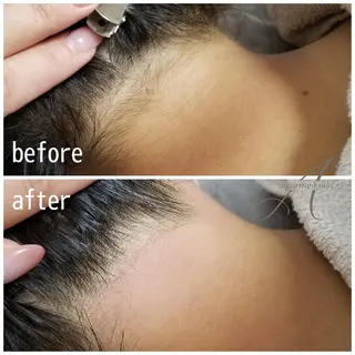 A*《エースター》 シュガーリング🍋のエステ・リラクイメージ