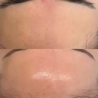 韓国🇰🇷価格 サロン_Nbibiのエステ・リラクイメージ