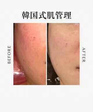 HEARTFUL BEAUTY所属・HEARTFUL BEAUTYのエステ・リラクイメージ