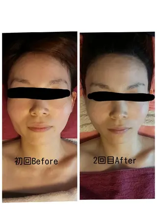 毛穴ケア くすみ肌 ハーブピーリングのエステ・リラクイメージ