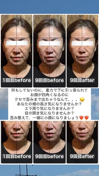💎後悔させない小顔 矯正💎イトヤマ🌱のエステ・リラクイメージ