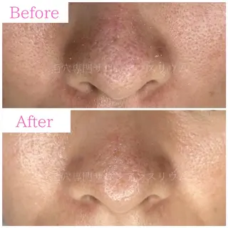 毛穴ケア専門サロンアンスリウム所属・茨城土浦 つくば毛穴 ケア専門サロンのエステ・リラクイメージ