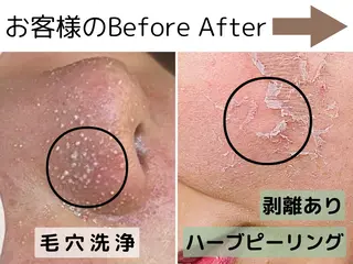 美肌サロン charme  宮川のエステ・リラクイメージ