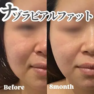 atelier . kyokoのマツエク・マツパデザイン