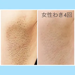 🌿Anis 🌿のマツエク・マツパデザイン