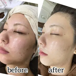 laluna saki...のその他イメージ