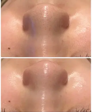 White Aqua京橋店所属・WHITE AQUAのエステ・リラクイメージ