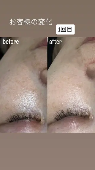 HALU _HARUのエステ・リラクイメージ