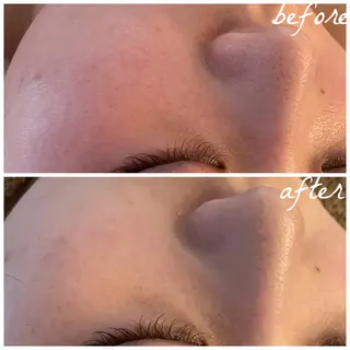 メンズ メナード岐阜市茜部 杉浦のエステ・リラクイメージ