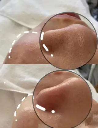 Angela エステサロンのマツエク・マツパデザイン