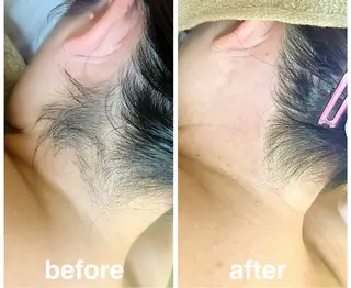 Nail & 高速脱毛 avenir【アヴニール】所属・WAX/眉/光脱毛 🌿リラク/小顔のエステ・リラクイメージ