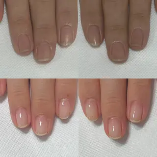 ネイル 自爪育成・巻き爪 補正講師　津蔵のネイルデザイン