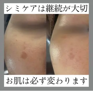 SPOT.com  シミケア専門店のエステ・リラクイメージ