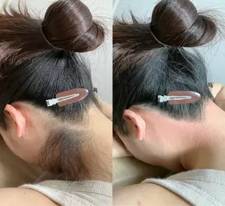 脱毛サロンBloom所属・Nami シュガーリングサロンのエステ・リラクイメージ