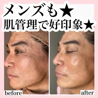 ハーブピーリング/ ララピール専門店のエステ・リラクイメージ