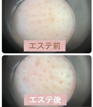 ネイル マツエク・マツパ アイブロウ 小倉 麻由のエステ・リラクイメージ