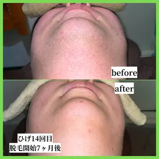 メンズ 【天神|個室】脱毛 You Makeのエステ・リラクイメージ