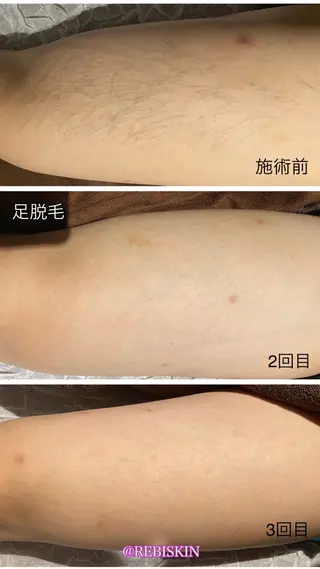 【痩身・脱毛サロン】 REBISKIN🌱のエステ・リラクイメージ