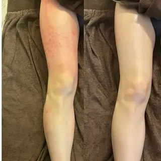 Re:Oasis所属・🦋Re:Oasis 近藤美貴【四谷】🦋のエステ・リラクイメージ