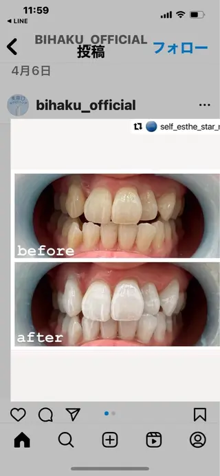 WHITENING ハウスのマツエク・マツパデザイン