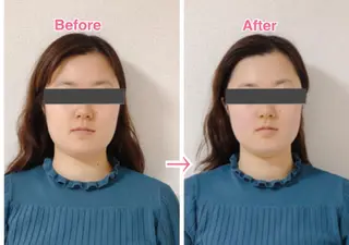 小顔・デトックスリンパ専門サロンRadiant Muse (ラディアントミューズ)所属・小顔・たるみ改善 ラディアントミューズのエステ・リラクイメージ