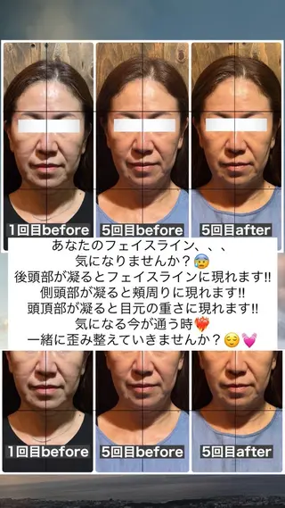 💎後悔させない小顔 矯正💎イトヤマ🌱のエステ・リラクイメージ