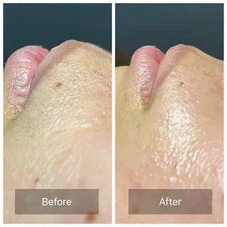 Salon   improve所属・Salon improve久留米のエステ・リラクイメージ