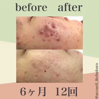 ミディアム カラー パーマ ヘアアレンジ メンズ ネイル マツエク・マツパ ニキビ・肌質改善専門 ♡人生が変わるサロンのエステ・リラクイメージ