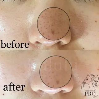 毛穴専門サロン　フルール所属・フルールFululu 自由が丘のエステ・リラクイメージ