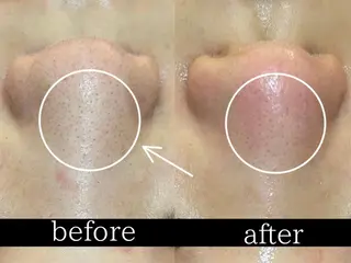 四ツ橋フェイシャル Rebornのエステ・リラクイメージ