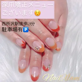 ネイル Nail×Lani 深爪矯正対応◎のネイルデザイン