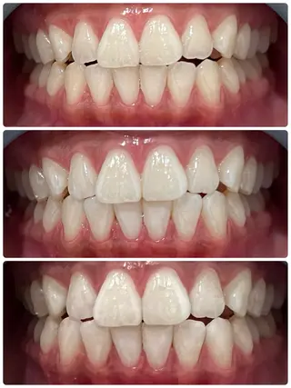 𝐑𝐞𝐯𝐢𝐨 ___堺市西区のマツエク・マツパデザイン