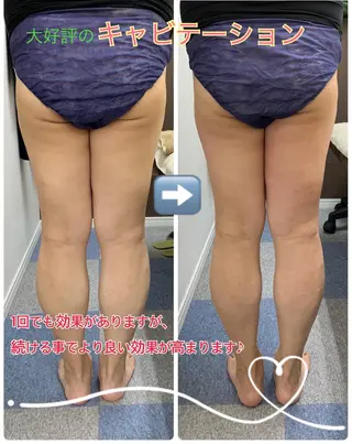 サポート鍼灸整骨院所属・サポート 鍼灸整骨院のエステ・リラクイメージ