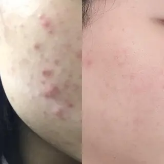 メンズ elle W所属・elle W staffのエステ・リラクイメージ